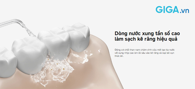 1774430185042-xiaomi-water-flosser-2-bhr9235gl-5.jpg